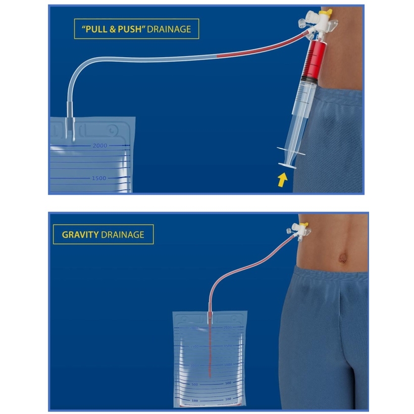 ALIVIA - Cateter multifuncțional, cod 10841