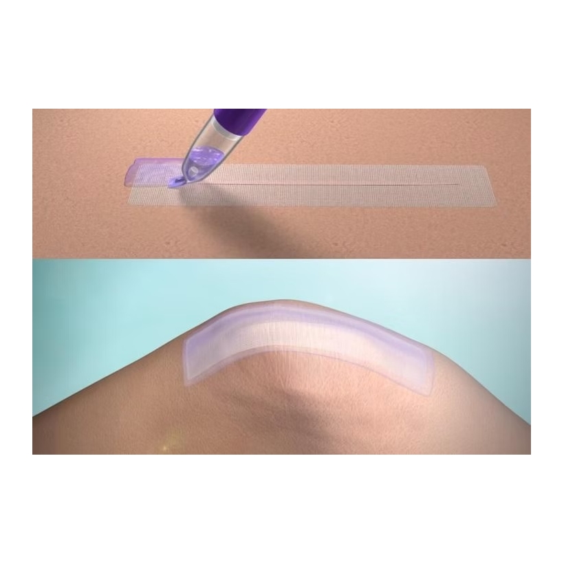 DERMABOND PRINEO 22cm cod CLR222
