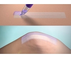 DERMABOND PRINEO 42см код CLR422