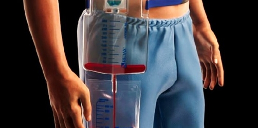 WearABLE: Un nou standard în mobilitate și siguranță pentru drenajul toracic