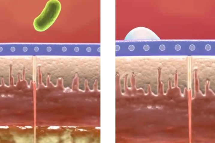 Dermabond micro water