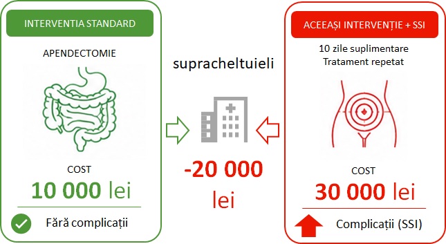 Supracheltuieli